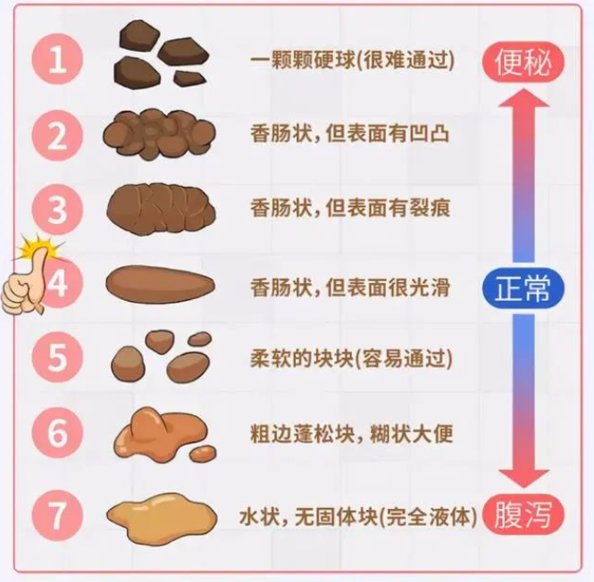 化验大便怎么采集给宝宝留便便做化验标本时应该如何正确留取？_https://www.jmylbn.com_新闻资讯_第3张