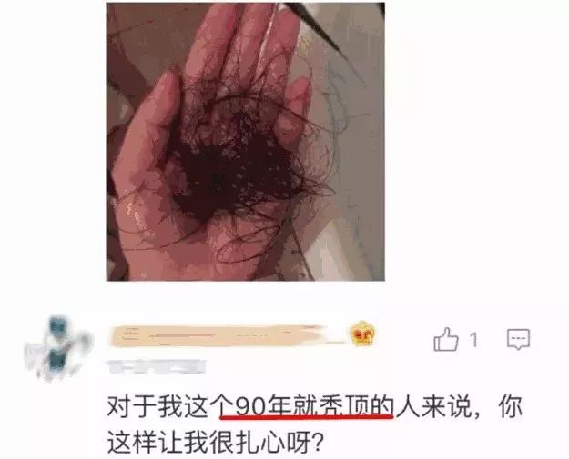 白发危机，你遇到了吗？了解白发与身体的关系