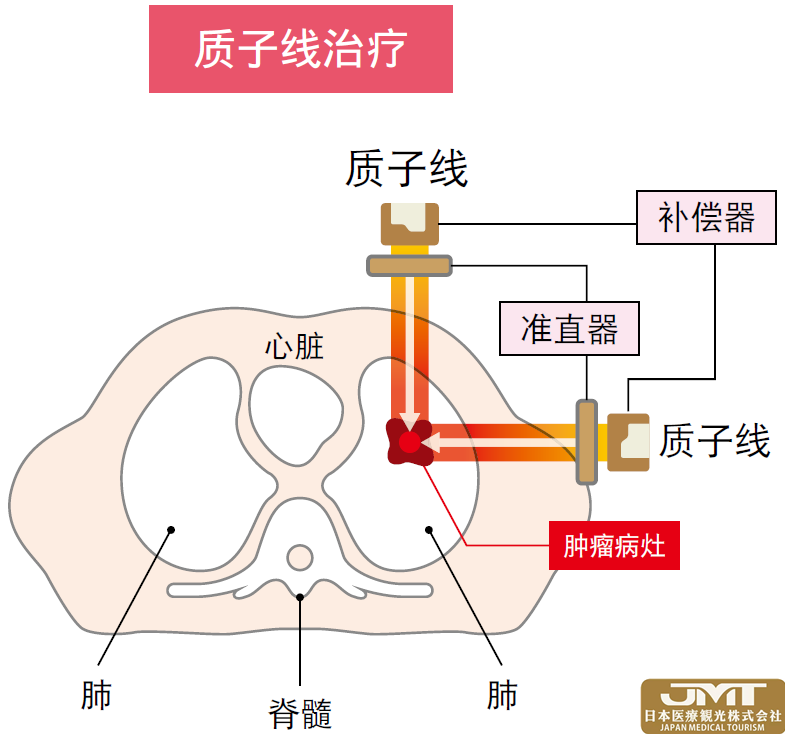 JMT日本医疗——筑波大学附属医院的质子治疗中心介绍②