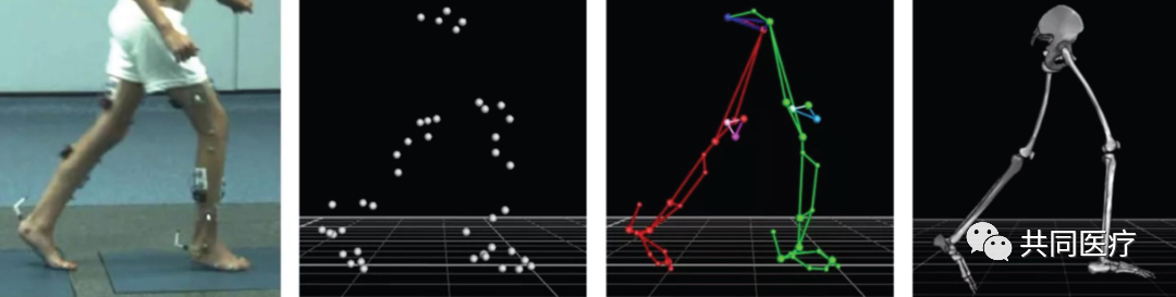 步态分析上曲线怎么解读超全的步态分析，值得收藏_https://www.jmylbn.com_新闻资讯_第9张