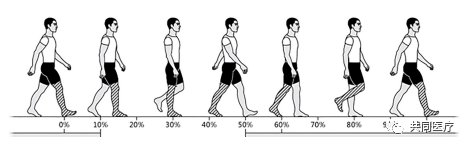 步态分析上曲线怎么解读超全的步态分析，值得收藏_https://www.jmylbn.com_新闻资讯_第11张