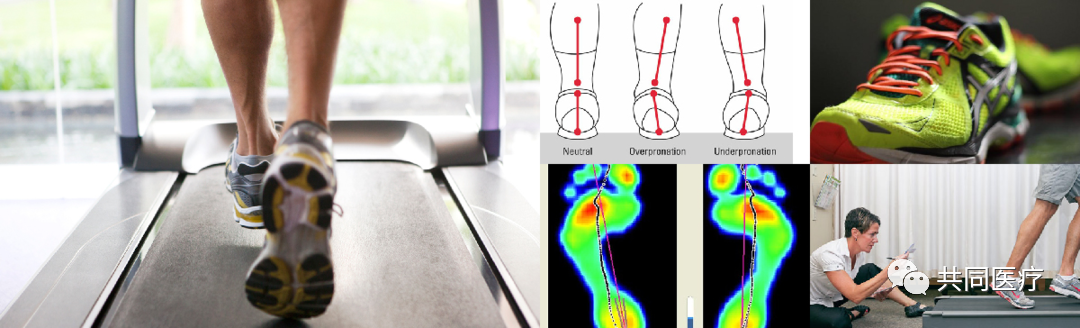 步态分析上曲线怎么解读超全的步态分析，值得收藏_https://www.jmylbn.com_新闻资讯_第29张