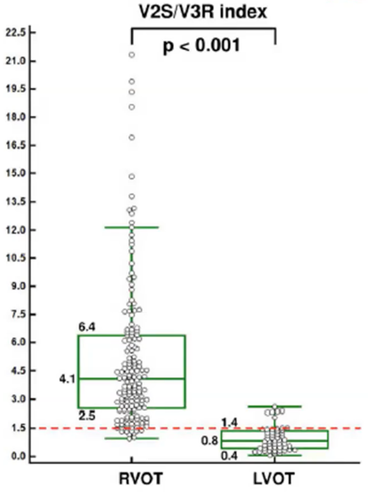 室性早搏的体表心电图定位