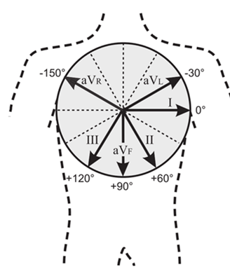 室性早搏的体表心电图定位