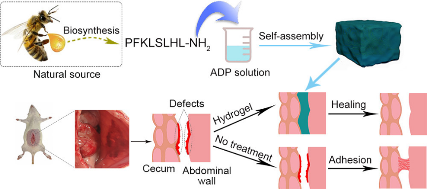 水凝胶伤口敷料怎么用让细菌无处遁形，让伤口安全愈合，一文带你看抗菌水凝胶敷料的设计策略_https://www.jmylbn.com_新闻资讯_第3张