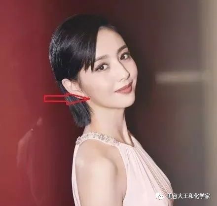 方颅图片和正常对比(额头上有个凹陷的坑怎么能消除) - 车世界