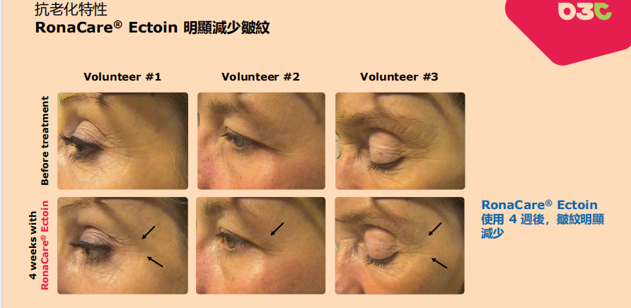 液体敷料批文怎么申请蓝佳堂独家获批二类医美抗衰修复敷料批文_https://www.jmylbn.com_新闻资讯_第8张