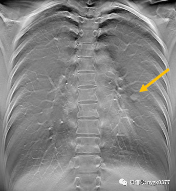 岛津有哪些影像设备岛津 C200拥有性能完善的影像链系统_https://www.jmylbn.com_新闻资讯_第8张