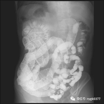 岛津有哪些影像设备岛津 C200拥有性能完善的影像链系统_https://www.jmylbn.com_新闻资讯_第5张