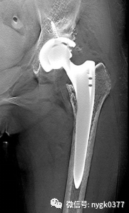 岛津有哪些影像设备岛津 C200拥有性能完善的影像链系统_https://www.jmylbn.com_新闻资讯_第11张