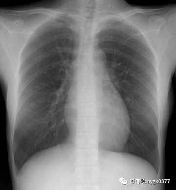 岛津有哪些影像设备岛津 C200拥有性能完善的影像链系统_https://www.jmylbn.com_新闻资讯_第7张