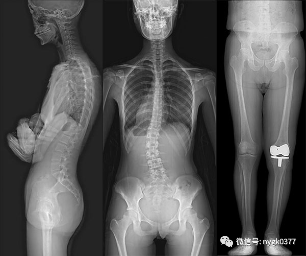 岛津有哪些影像设备岛津 C200拥有性能完善的影像链系统_https://www.jmylbn.com_新闻资讯_第13张