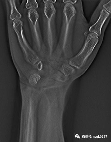 岛津有哪些影像设备岛津 C200拥有性能完善的影像链系统_https://www.jmylbn.com_新闻资讯_第10张