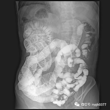 岛津有哪些影像设备岛津 C200拥有性能完善的影像链系统_https://www.jmylbn.com_新闻资讯_第6张