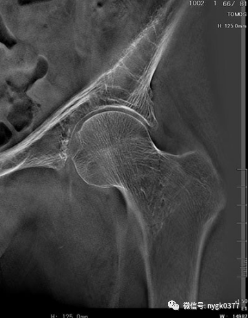 岛津有哪些影像设备岛津 C200拥有性能完善的影像链系统_https://www.jmylbn.com_新闻资讯_第9张