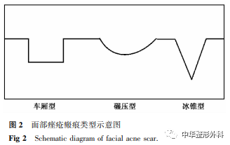 二氧化碳(co2)激光治疗是什么点阵CO2激光综合模式治疗面部凹陷性痤疮瘢痕的临床效果_https://www.jmylbn.com_新闻资讯_第3张