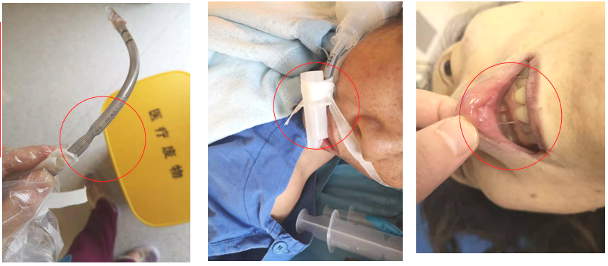 这家医院护士的小发明，让护理工作更出彩！