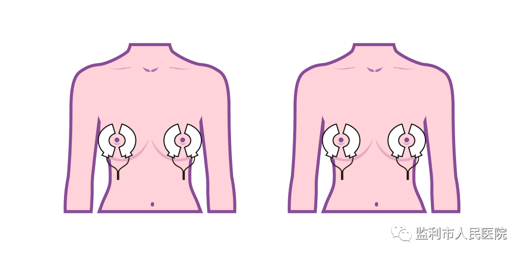产后康复治疗仪怎么用产后康复治疗——低频仪治疗_https://www.jmylbn.com_新闻资讯_第4张
