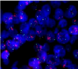 fh染色检测是什么一文了解——荧光原位杂交技术（FISH）_https://www.jmylbn.com_新闻资讯_第2张