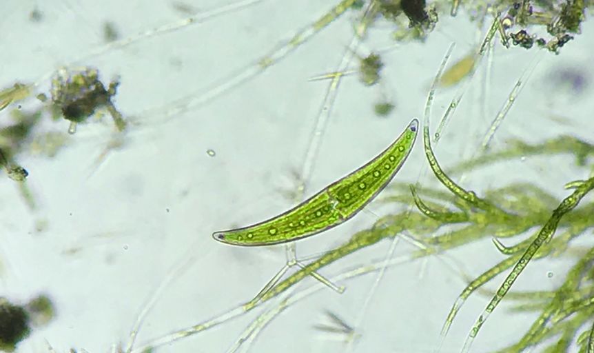 一滴水中的"八万四千虫",都有哪些?| 果壳 科技有意思