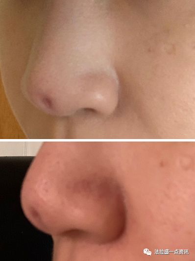 美容变毁容！嚣张华女专“宰熟”，扬言：我老公是警察（组图） - 6