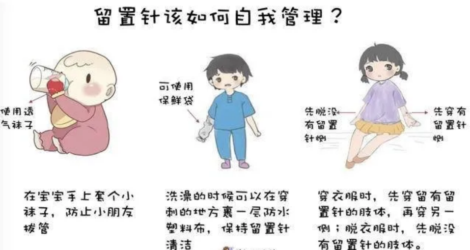 bd留置针怎么使用使用留置针期间的护理，应该怎样做？_https://www.jmylbn.com_新闻资讯_第2张