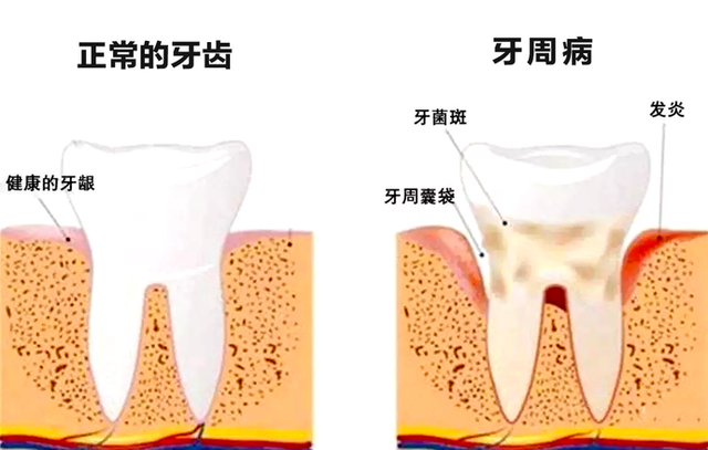 【惊呆】30多岁的小伙子因牙齿松动就诊,结果全口牙