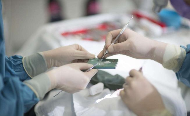 口腔光固化灯是什么光最全的树脂知识都在这了_https://www.jmylbn.com_新闻资讯_第11张