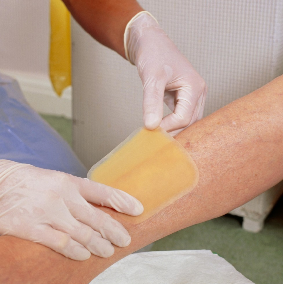 为什么输液要盖块纱布【健康科普】护士，我的手打肿了怎么办？_https://www.jmylbn.com_新闻资讯_第9张