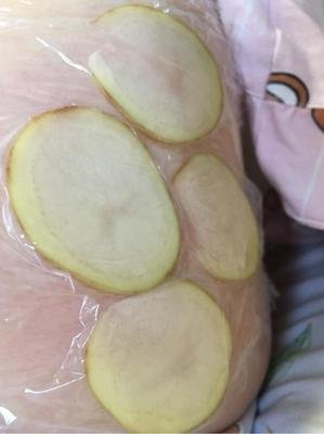 为什么输液要盖块纱布【健康科普】护士，我的手打肿了怎么办？_https://www.jmylbn.com_新闻资讯_第12张