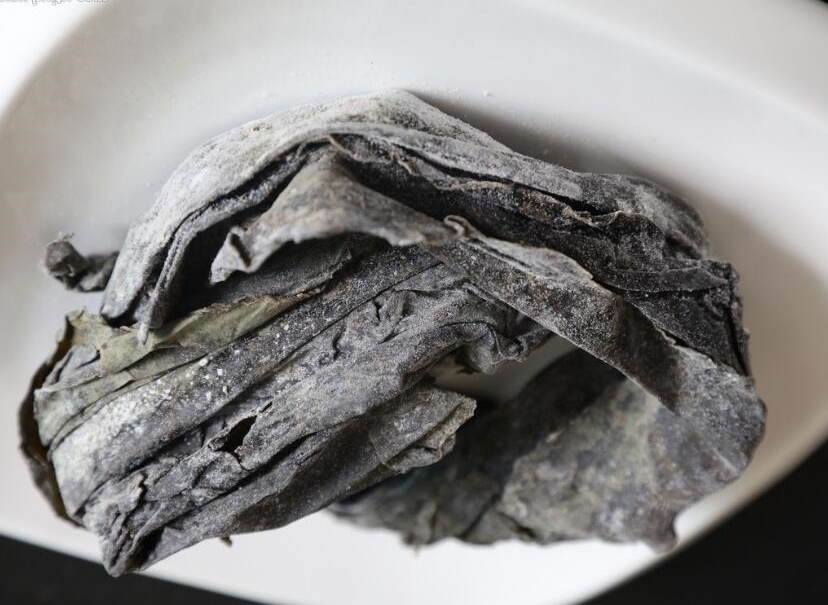 为什么输液要盖块纱布【健康科普】护士，我的手打肿了怎么办？_https://www.jmylbn.com_新闻资讯_第15张