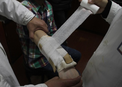 医用骨夹板怎么用竹夹板治疗桡骨远端骨折技术_https://www.jmylbn.com_新闻资讯_第11张