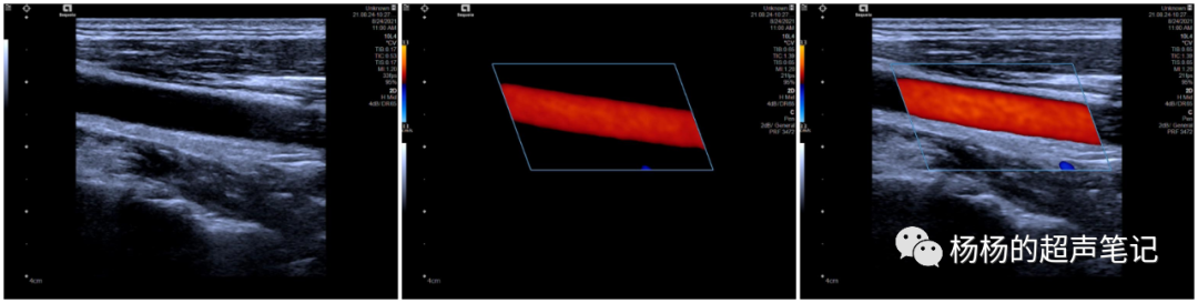 什么是超声容积探头超声基础知识(1)—超声探头的基本构造_https://www.jmylbn.com_新闻资讯_第5张