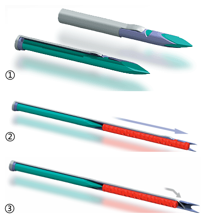 半自动活检针怎么用介入基础知识(1)—活检针分类及切割原理_https://www.jmylbn.com_新闻资讯_第8张