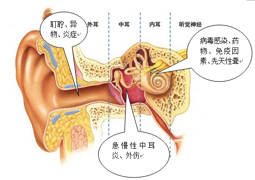 中耳筛查怎么做【科普】2022年全国爱耳日——关爱听力健康，聆听精彩未来！_https://www.jmylbn.com_新闻资讯_第6张