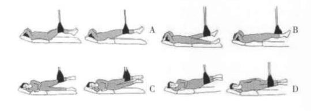 悬吊训练系统 怎么装悬吊训练疗法（SET）如何应用在脑损伤患者中，你知道吗？_https://www.jmylbn.com_新闻资讯_第24张