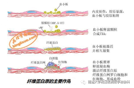 不同寻常的低纤维蛋白原的少见病例患病原因竟是