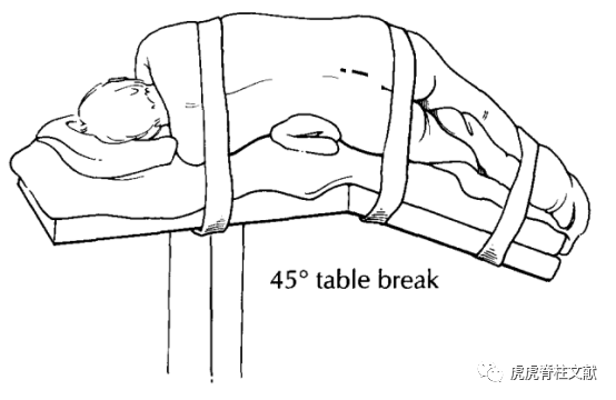为什么会有单关节器械早读 ｜ 腰椎单边双通道内镜技术诞生的历史沿革_https://www.jmylbn.com_新闻资讯_第4张