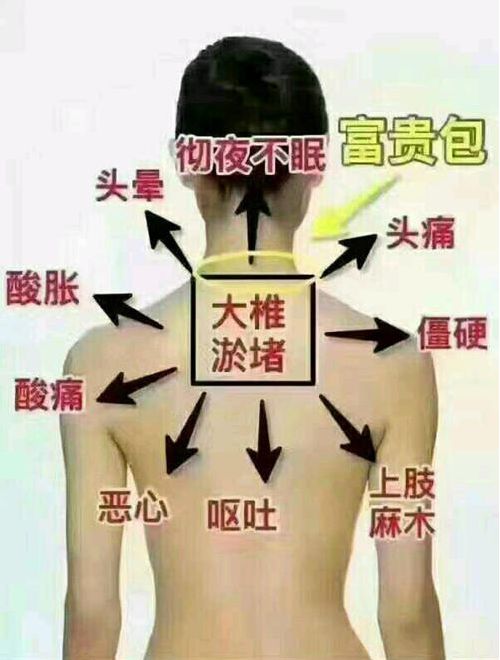 90%的人猝死，竟都跟肩颈有关？！