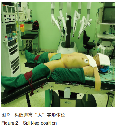 为什么使用手术对接车优秀论文 ｜ 机器人辅助腹腔镜下前列腺癌根治性切除术改良仰卧位与常规体位的对照研究_https://www.jmylbn.com_新闻资讯_第2张