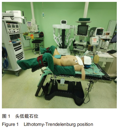 为什么使用手术对接车优秀论文 ｜ 机器人辅助腹腔镜下前列腺癌根治性切除术改良仰卧位与常规体位的对照研究_https://www.jmylbn.com_新闻资讯_第1张