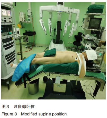 为什么使用手术对接车优秀论文 ｜ 机器人辅助腹腔镜下前列腺癌根治性切除术改良仰卧位与常规体位的对照研究_https://www.jmylbn.com_新闻资讯_第3张