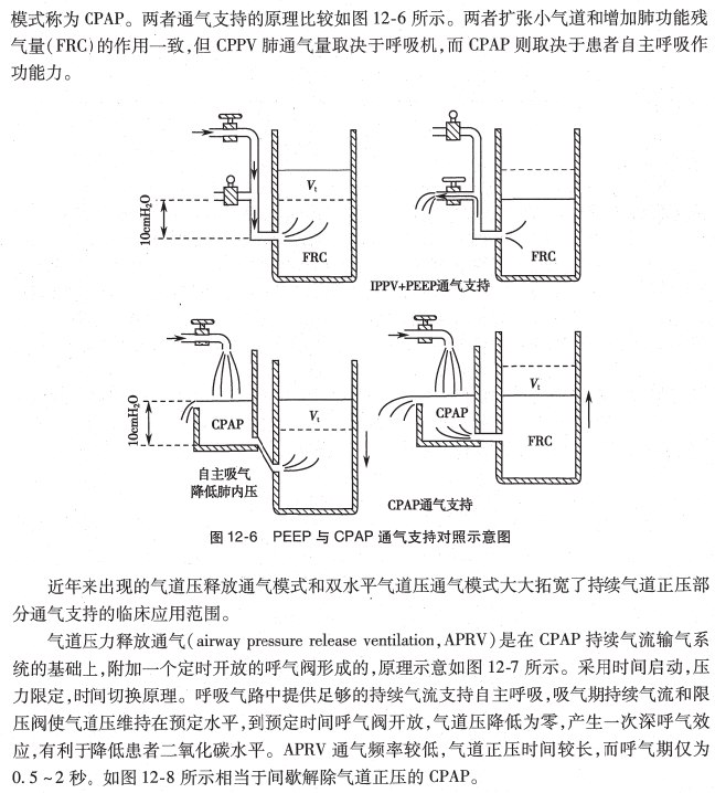 呼吸机ac是什么意思O.A. （474）麻醉设备学（4）呼吸机_https://www.jmylbn.com_新闻资讯_第9张