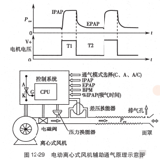 呼吸机ac是什么意思O.A. （474）麻醉设备学（4）呼吸机_https://www.jmylbn.com_新闻资讯_第30张
