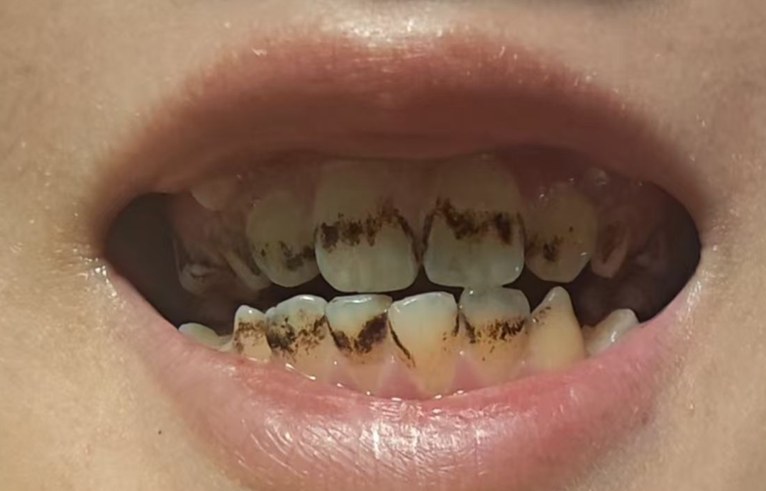 治疗床怎么用看着在治疗床上哇哇哭的孩子，“再也不敢了，这一件我还是老老实实给孩子买贵的…”_https://www.jmylbn.com_新闻资讯_第8张