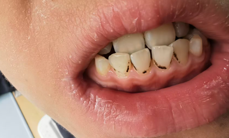 治疗床怎么用看着在治疗床上哇哇哭的孩子，“再也不敢了，这一件我还是老老实实给孩子买贵的…”_https://www.jmylbn.com_新闻资讯_第7张