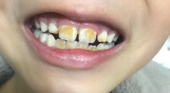 治疗床怎么用看着在治疗床上哇哇哭的孩子，“再也不敢了，这一件我还是老老实实给孩子买贵的…”_https://www.jmylbn.com_新闻资讯_第6张