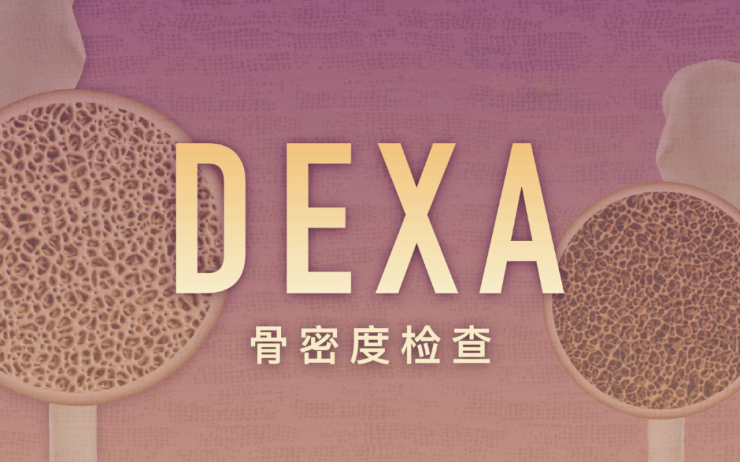 双能x骨密度检测仪为什么非得输入体重身高【查骨质疏松】双能X线骨密度检测→为您的健康“骨”把劲儿！_https://www.jmylbn.com_新闻资讯_第8张