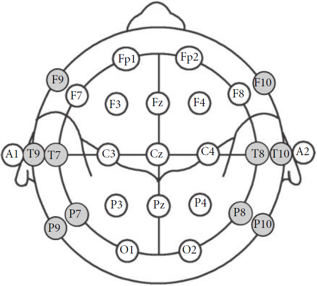 12导为什么是标准导联临床脑电图基本技术标准_https://www.jmylbn.com_新闻资讯_第7张