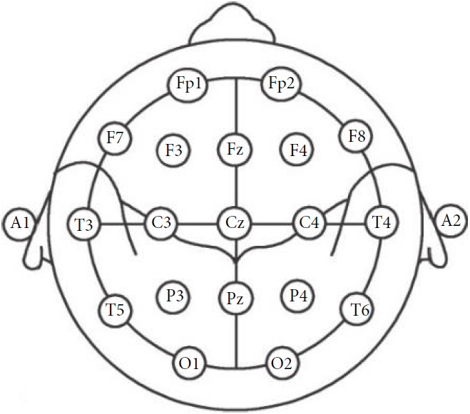 12导为什么是标准导联临床脑电图基本技术标准_https://www.jmylbn.com_新闻资讯_第5张